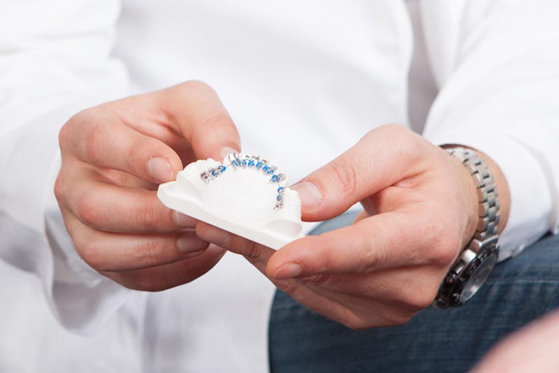 Дизайн идеальной улыбки