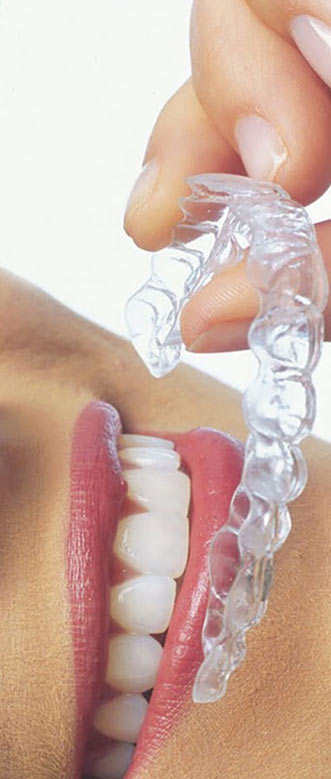 невидимые каппы