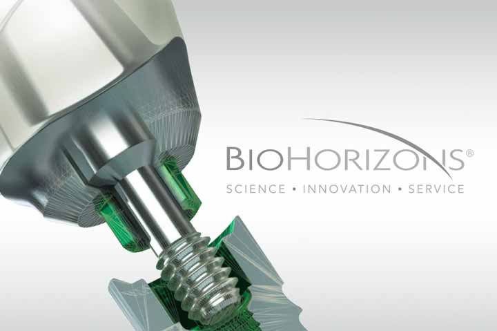 Импланты Биогоризонт