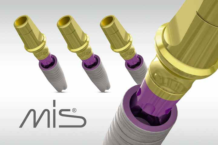 Импланты Мис