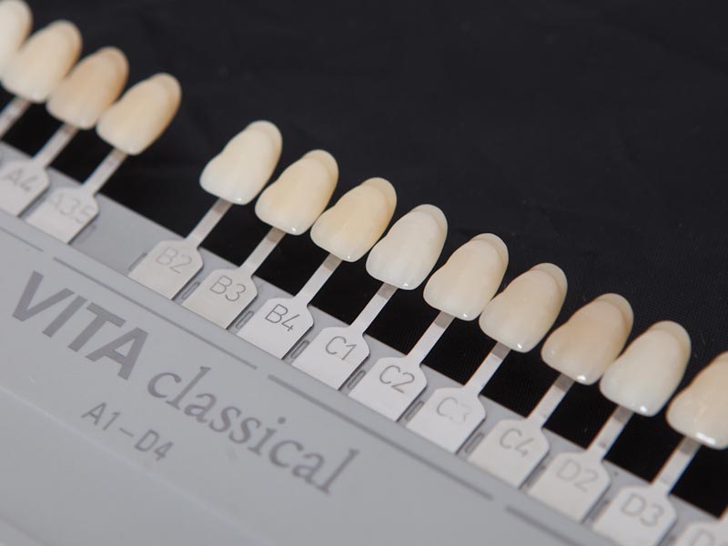 процедура лазерного отбеливания