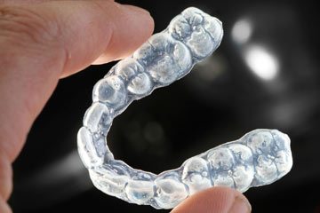 Невидимые брекет системы